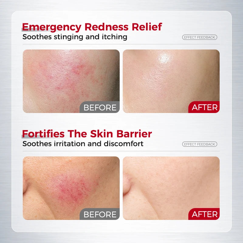 Ceramide Barrier Cream – Hydrating & Soothing Moisturiser